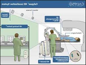 Calypso 4D Localization SystemÃ³GPS for the Body